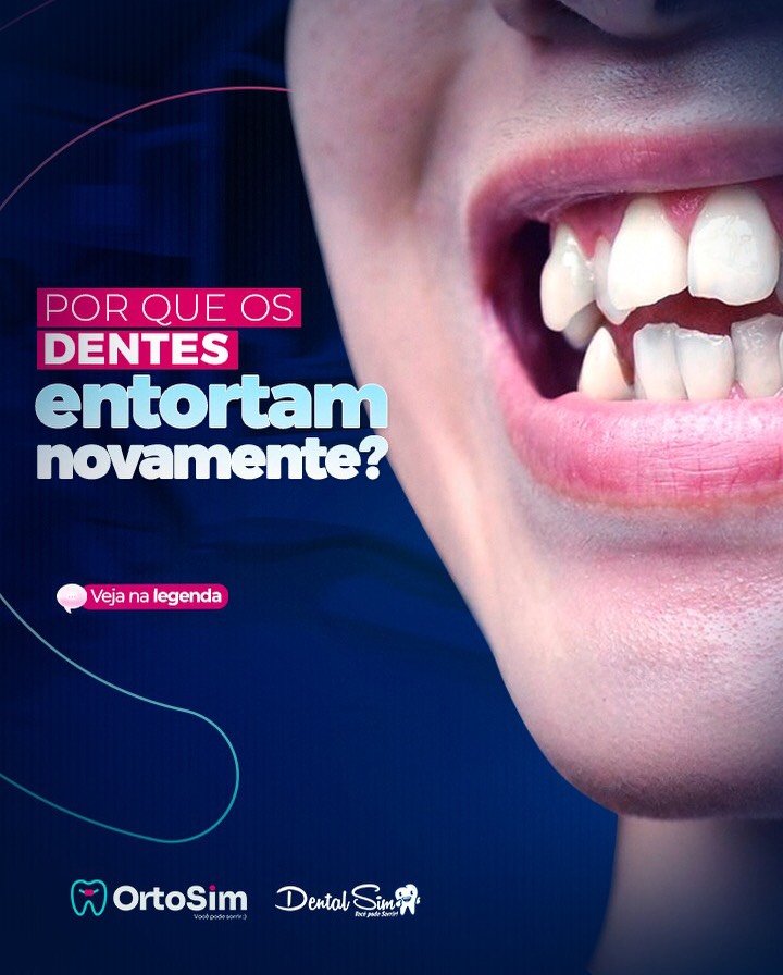 Por que os dentes entortam novamente?