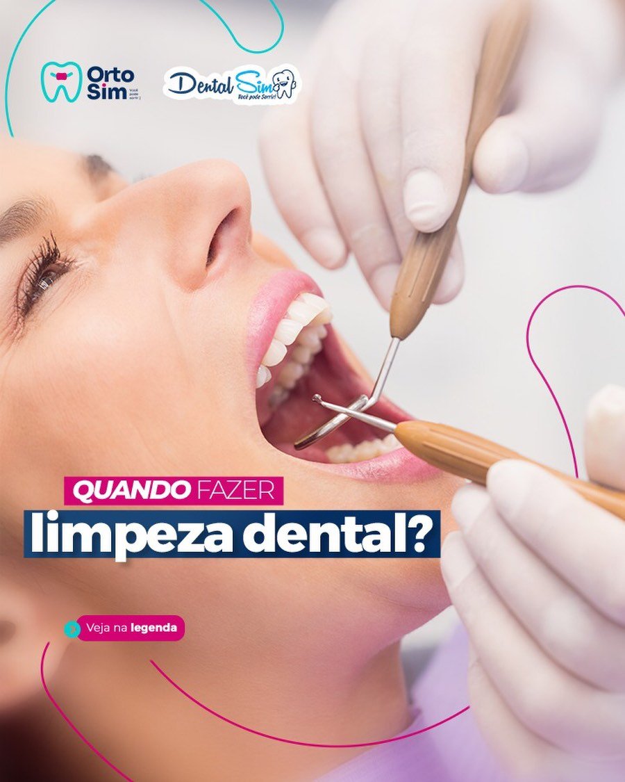 Quando fazer limpeza dental?