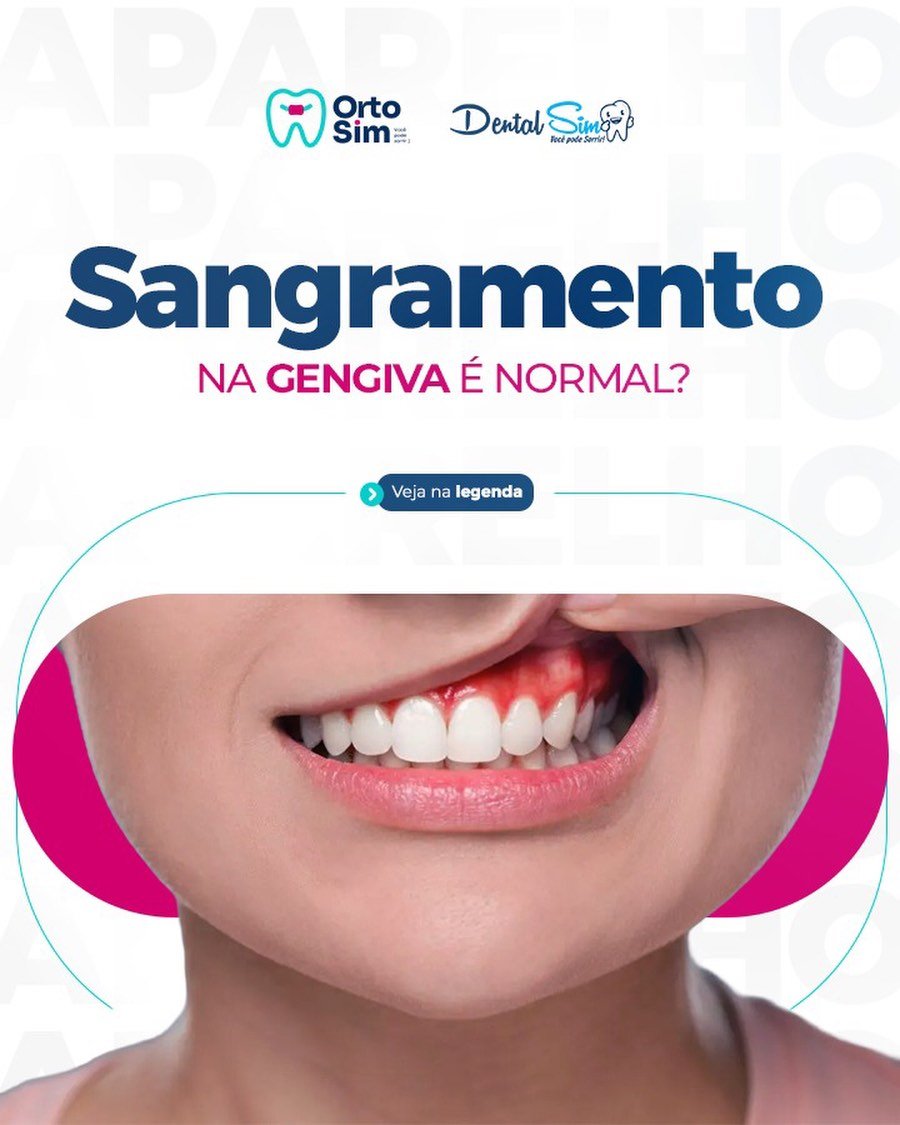 Sangramento na gengiva é normal?